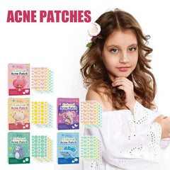 144PCS Star Pimple Patch – Colorful & Invisible Acne Care Stickers