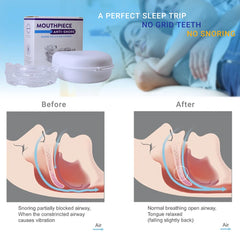New Mouth Guard Anti-Snoring Teeth Bruxism Mouthguard Improves Sleep Teeth Bruxism Sleep and Apnea Snoring Device Stops Snoring