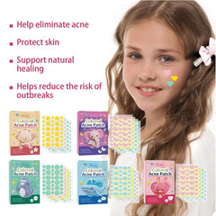 144PCS Star Pimple Patch – Colorful & Invisible Acne Care Stickers